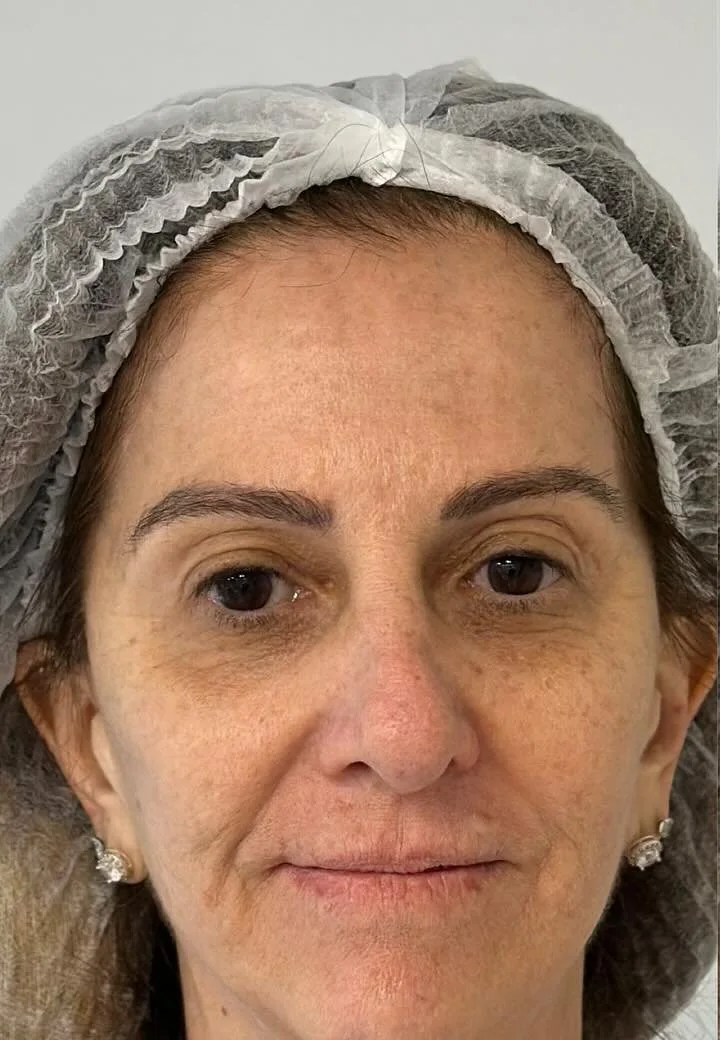 Antes